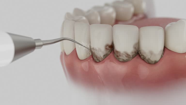Trusted Root Canal Treatment service in Thorsby, AL - Dentist Open Now